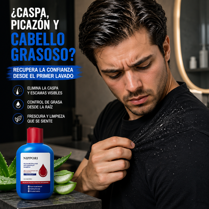 SHAMPOO ANTICASPA 120 ML HOEGOA FRESH SCALP — CONTROL DE GRASA Y FRESCURA TOTAL 🌿✨
