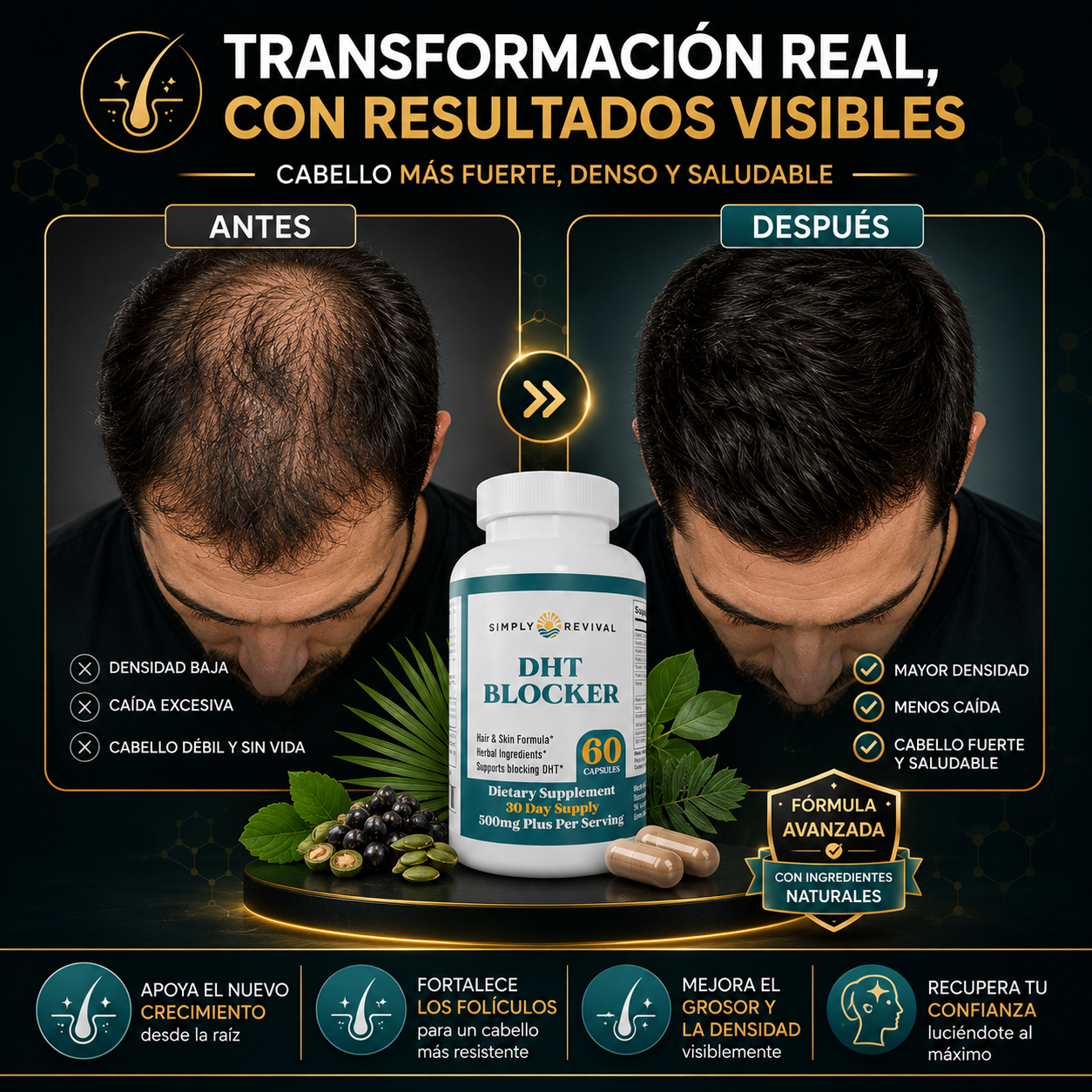 DHT BLOCKER™ | APOYA EL NUEVO CRECIMIENTO Y REDUCE EL DESPRENDIMIENTO 🚀✨