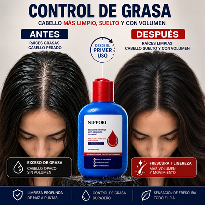 SHAMPOO ANTICASPA 120 ML HOEGOA FRESH SCALP — CONTROL DE GRASA Y FRESCURA TOTAL 🌿✨